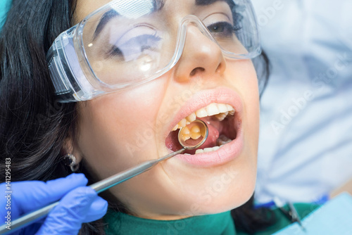 Tableau sur toile Dental patient and concave mirror. Teeth of young woman.