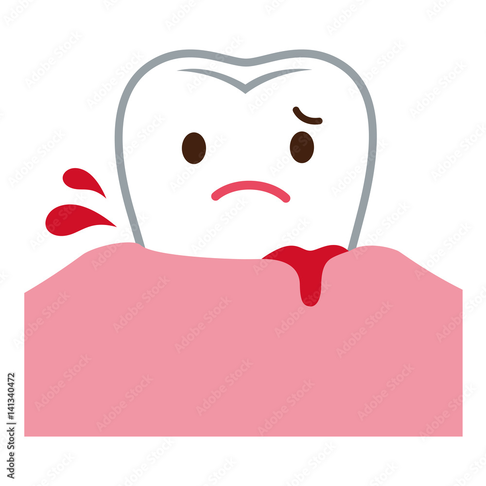 歯ぐきから出血する 歯周病 Stock イラスト Adobe Stock