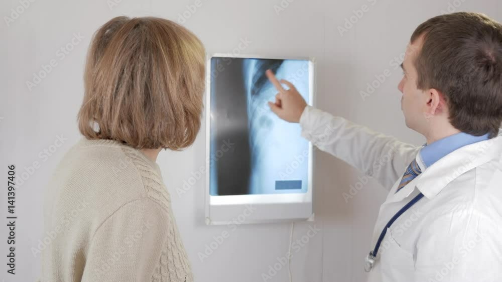 A young male doctor shows the results of an X-ray to an elderly woman. Problems with the ribs. The man speaks the diagnosis. A young male doctor shows the results of an X-ray to an elderly woman. Problems with the ribs. The man speaks the diagnosis.
