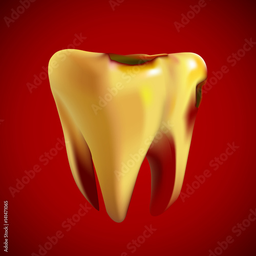 Bad sick yellow tooth with caries. Vector illustration.