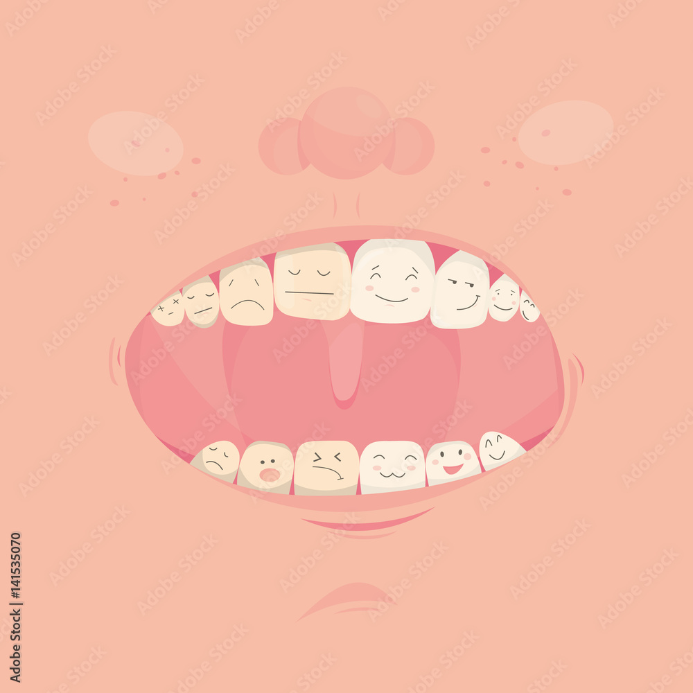 .Modern vector illustration of open cute mouth with cartoon friendly teeth..Before and After Bleaching treatment. Teeth whitening