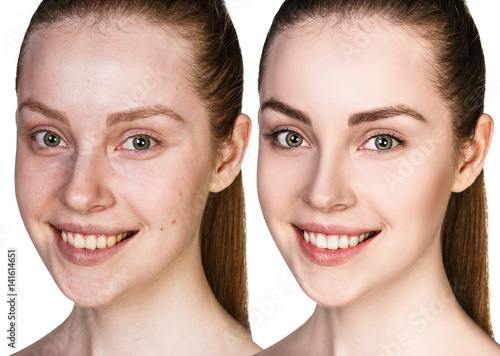 Young woman without and with makeup