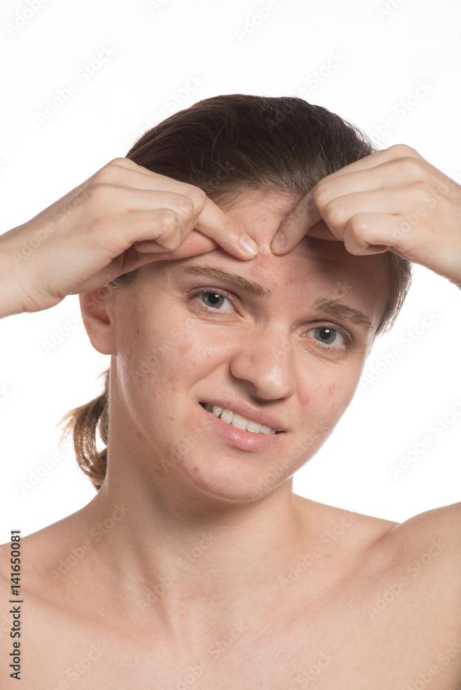 Beautiful young girl with red and white acne on her face. Before and after cream with sponge on a white background.