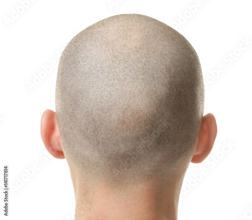 Fototapeta Naklejka Na Ścianę i Meble -  Hair loss concept. Head of man on white background, closeup