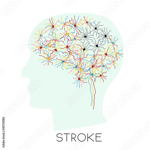 Stroke concept with human head silhouette