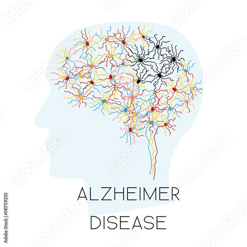 alzheimer disease concept