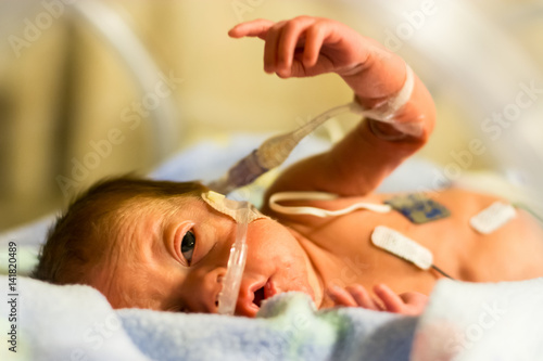 Preemie baby girl pointing in her incubator photo