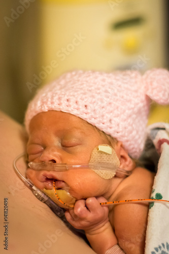 Photography Preemie baby girl getting some skin to skin care with dad