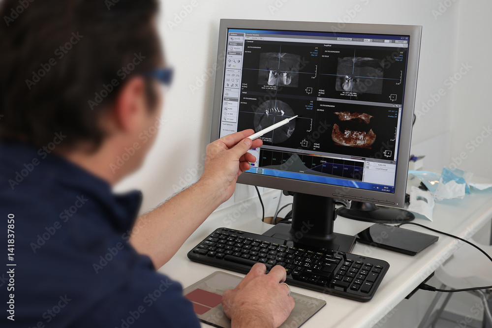 Dental x-rays being examined on computer screen by oral surgeon in a dental clinic Dental x-rays being examined on computer screen by oral surgeon in a dental clinic