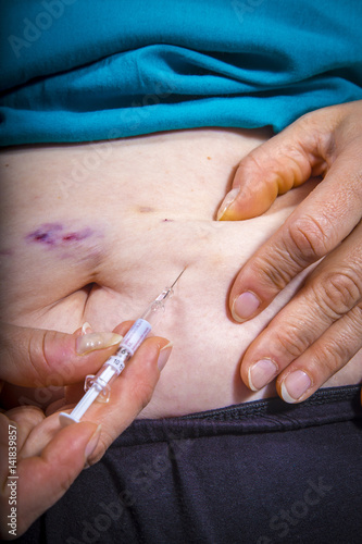 Adult woman self Injecting medical therapy with bruises on her stomach. Chemotherapy. Medical concept