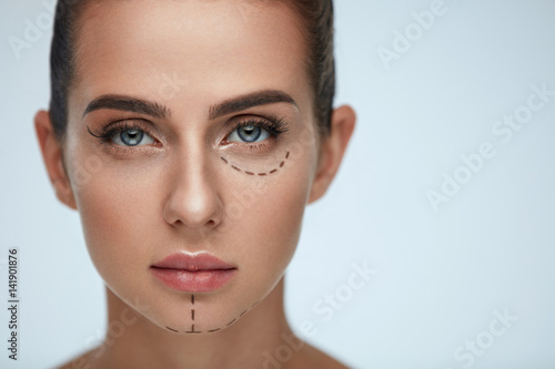 Plastic Surgery Operation. Woman Face With Black Surgical Lines photo