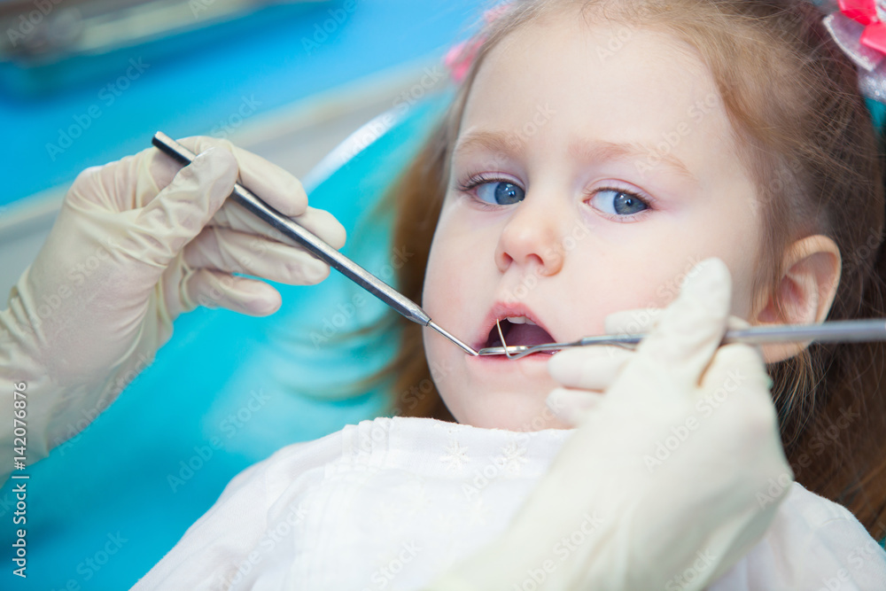 Close-up of pretty little girl opening his mouth wide during inspection of oral cavity at the dentist Close-up of pretty little girl opening his mouth wide during inspection of oral cavity at the dentist