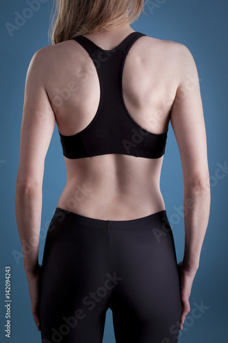 Female back pain © James Carroll