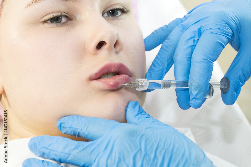The process of cosmetic surgery of water injection in the area of the lips of a woman The process of cosmetic surgery of water injection in the area of the lips of a woman