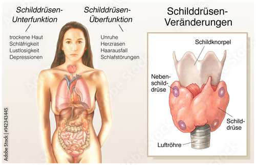 Krankmacher Schilddrüse photo