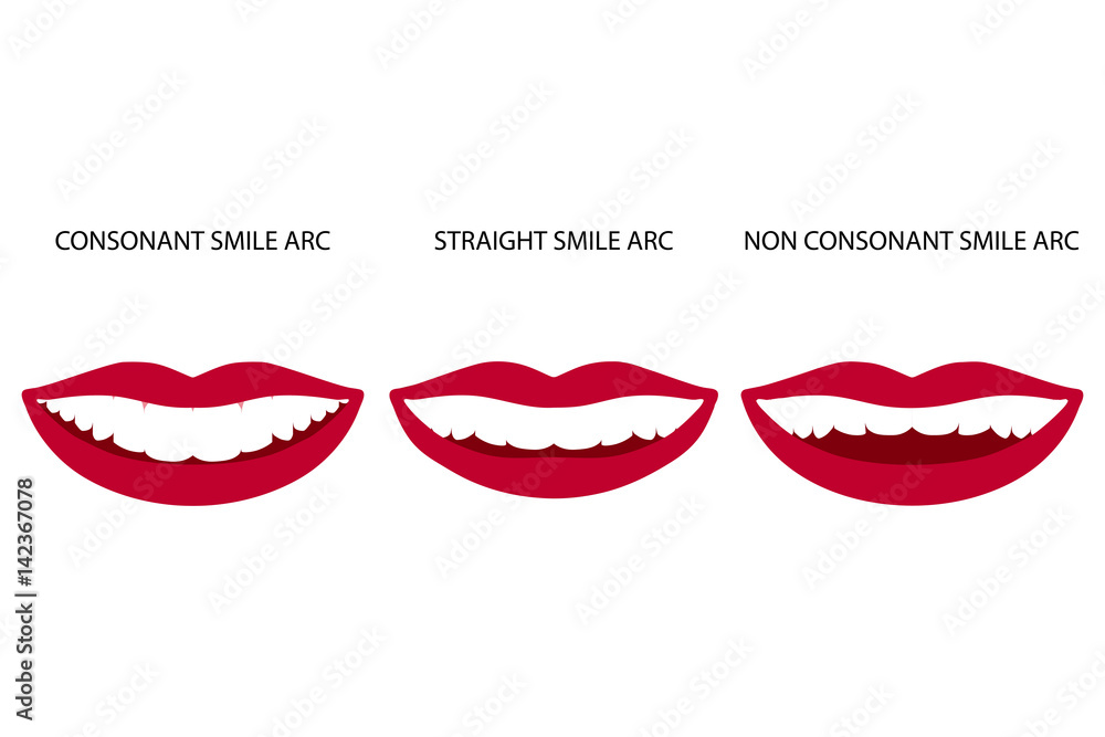 Smile arch set. Vector illustration. Smile arch set. Vector illustration.
