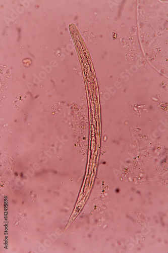 Strongyloides stercoralis