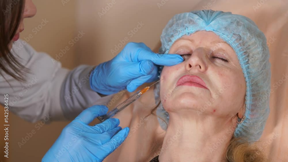 A plastic surgeon in a private clinic injects the cannula into the neck of a middle-aged woman, the drug fillers are in a syringe with a long needle that the doctor moves to the sides. A plastic surgeon in a private clinic injects the cannula into the neck of a middle-aged woman, the drug fillers are in a syringe with a long needle that the doctor moves to the sides.