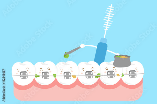 tooth wear brace with brush