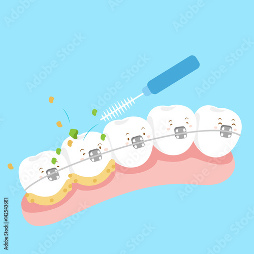 tooth wear brace with brush