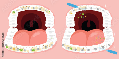 tooth cleaning problem