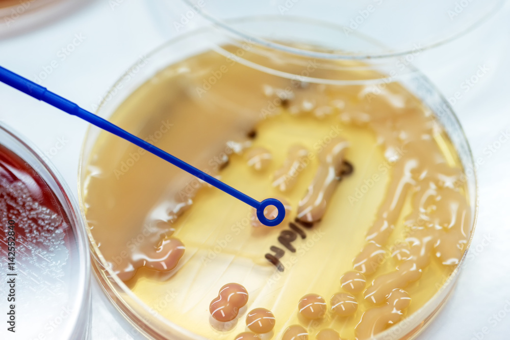 Klebsiella pneumoniae colonies of pink bacteria ferment lactose culture on MacConkey agar in microbiology department hospital. Klebsiella pneumoniae colonies of pink bacteria ferment lactose culture on MacConkey agar in microbiology department hospital.
