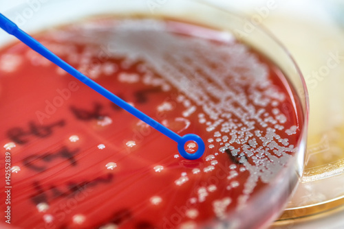 Foto Staphylococcus speciesm( Staphylococcus  aureus) to colonies of white bacteria culture on blood agar in microbiology department hospital