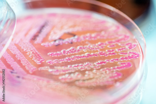 Close up the media plate on hand medical technicians working on bacterial culture and drug resistance of pathogens in laboratory. photo