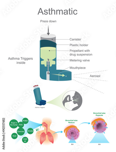 Asthmatic