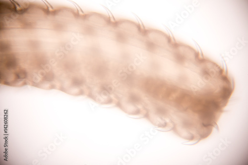Moniliformis moniliformis (Thorny-head worm) of education in laboratory.