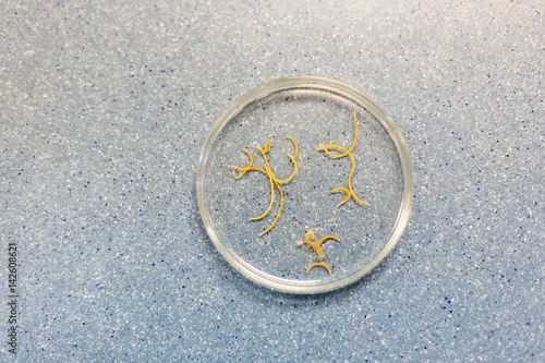 Ascaris of education in laboratory.