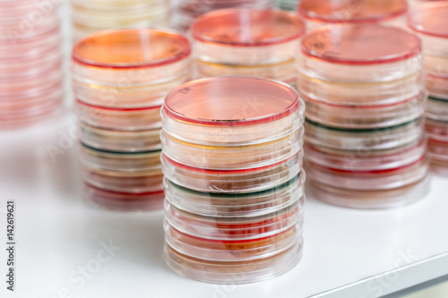 Red and yellow petri dishes stacks in microbiology lab on the bacteriology laboratory background.