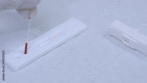 Hiv test equipment on table. Close up of lancelet on white table. Blood test needle on white background. Medical testing equipment. Test blood analyzer. Blood test hiv. Blood testing photo