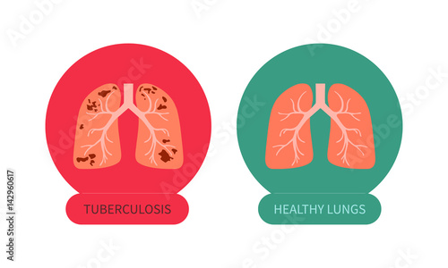 Tuberculosis versus healthy lungs symbol. TB awareness sign. Medical solidarity day concept. Anatomy of people. Vector illustration made in cartoon style.