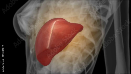 X-ray of the liver