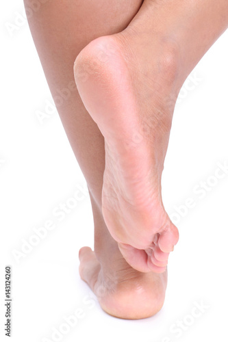 dehydrated skin on the heels of female feet.