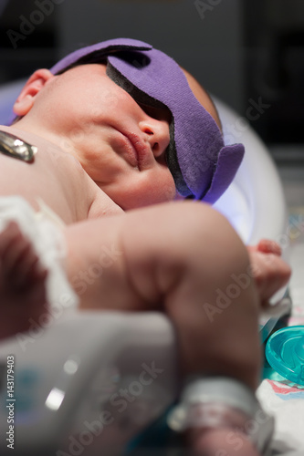 newborn baby with jaundice getting ulta violet phototherepy treatment photo