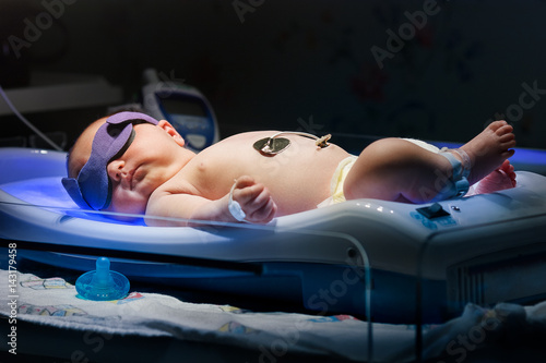newborn baby with jaundice getting ulta violet phototherepy treatment