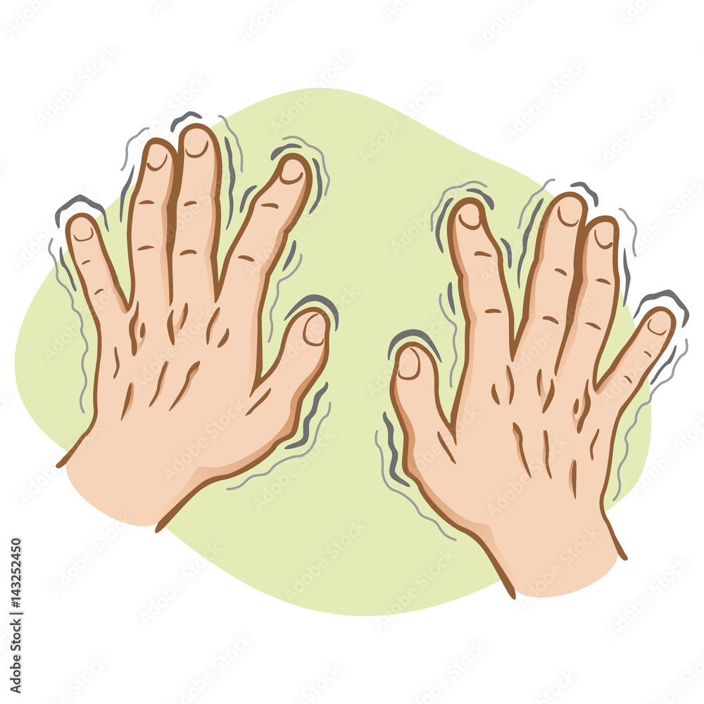 Close part of the body, pair of hands shaking symptoms of, Parkinson's