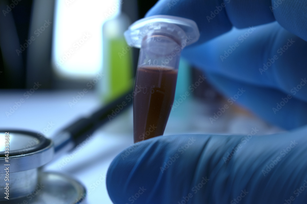Gloved Hand Holding Research Vial, Stem Cell Research Substance in Vial Gloved Hand Holding Research Vial, Stem Cell Research Substance in Vial