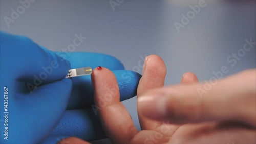 Macro shot of testing for diabetes. Doctor using glucometer to measure female's patient blood sugar. photo