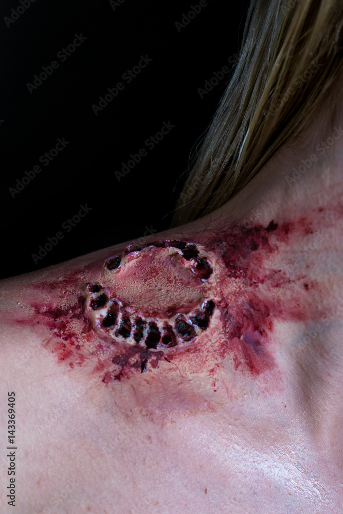 Naklejka premium Fresh bloody bite from a zombie or monster on a shoulder of blonde woman. Scarry scene.