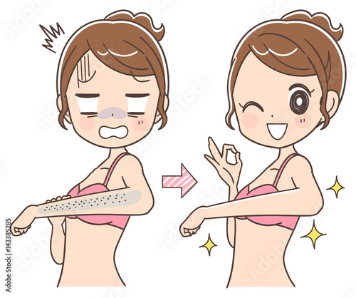 むだ毛ケアのビフォーアフター
