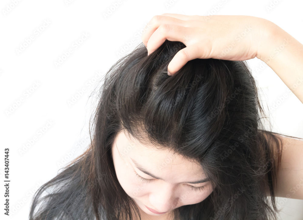 Closeup woman hand itchy scalp, Hair care concept Closeup woman hand itchy scalp, Hair care concept
