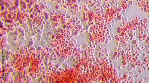 Human Blood 400x Microscope view of red blood cells clumping time lapse.