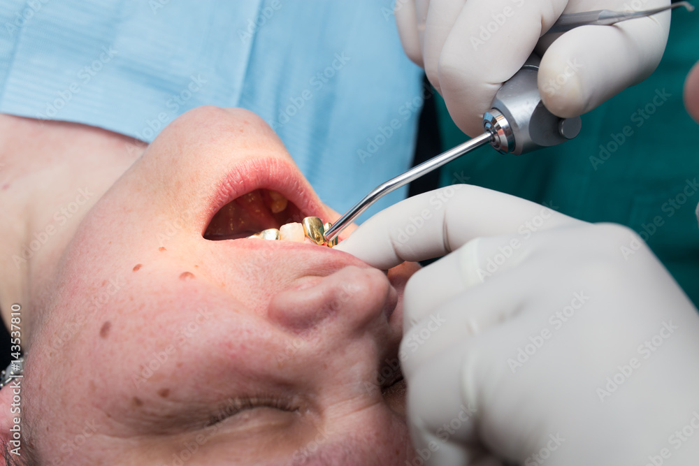 The dentist works with the client in the clinic The dentist works with the client in the clinic