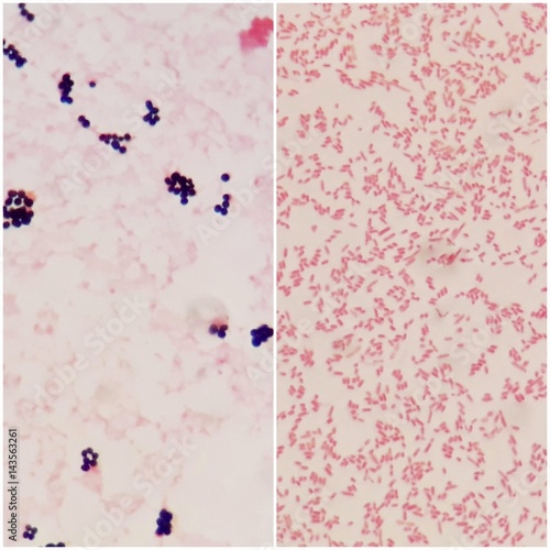 Smear of gram positive bacteria on the left and gram negative bacteria on the right, under 100X light microscope. © Sirikwan