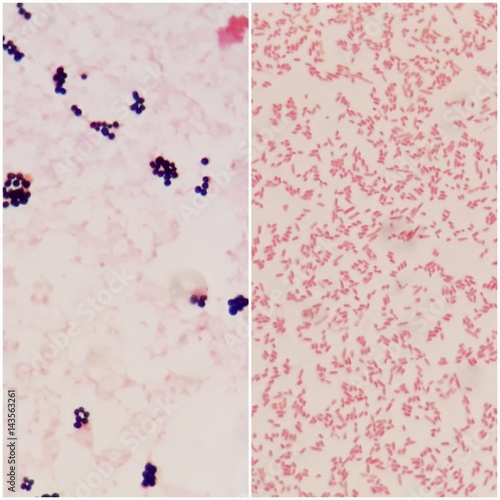 Smear of gram positive bacteria on the left and gram negative bacteria on the right, under 100X light microscope. photo