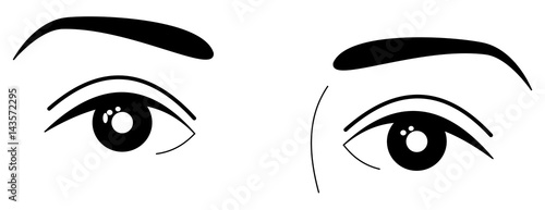 Black eyes