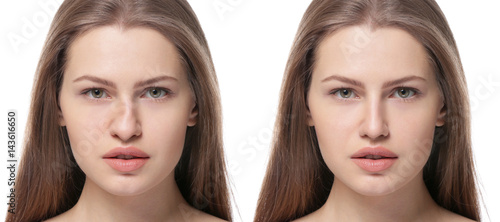 Foto Young woman before and after rhinoplasty on white background